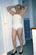 Pat, modelling her plaster cast